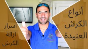 ازلة الكرش و دهونه البطن – انواع الكرش وحيل التخلص منه -2019