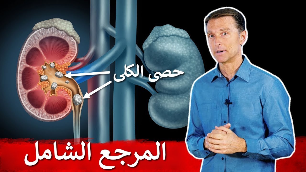 نصيحتي لتجنب حصى الكلى | دكتور بيرج