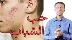 حب الشباب | أسباب مشاكل البشرة وعلاقة الهرمونات – حل نهائي