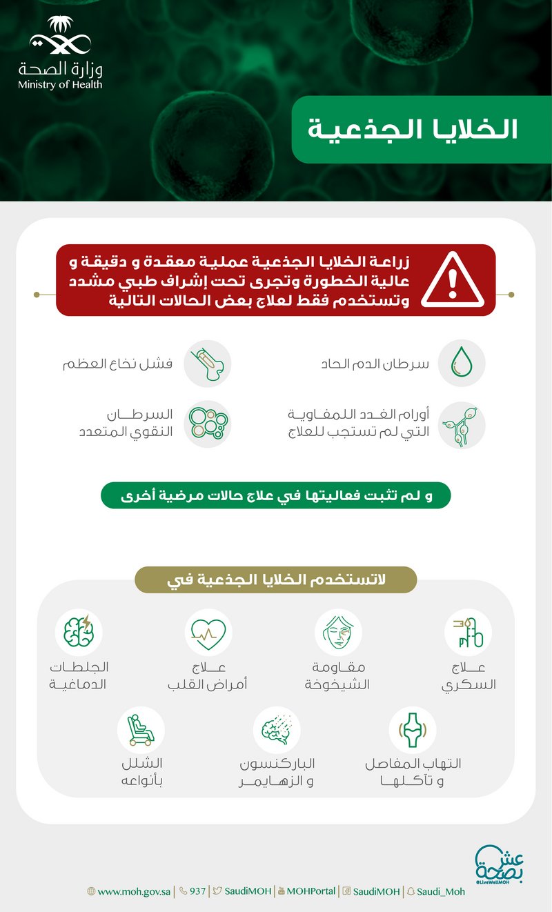 الخلايا الجذعية إجراء طبي عالي