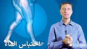 التخلص من احتباس الماء الزائد بالجسم بدون أدوية – اسبابه وعلاجه الفعال والسريع