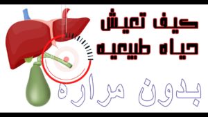 ازاله او استئصال المراره. ٥ اسرار غذائيه لاستعادة تركيز العصارة الصفراء