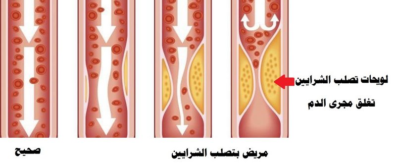 بشرى خير.. اكتشاف بروتين يحمي من أخطر أمراض القلب