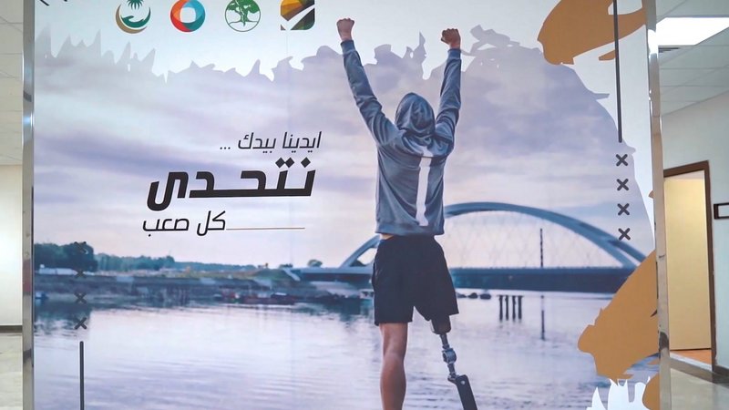 مرضى “السكري” يستحوذون على 74% من صناعة الأطراف