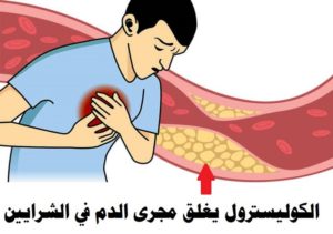 4 ملاعق كبيرة من هذا الزيت يوميًّا تخفض الكوليسترول في الد