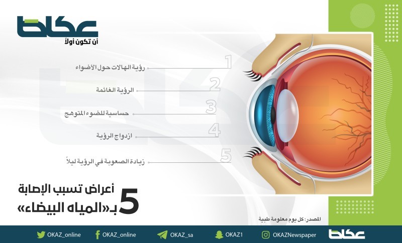 5 أعراض تسبب الإصابة بـ«المياه البيضاء»