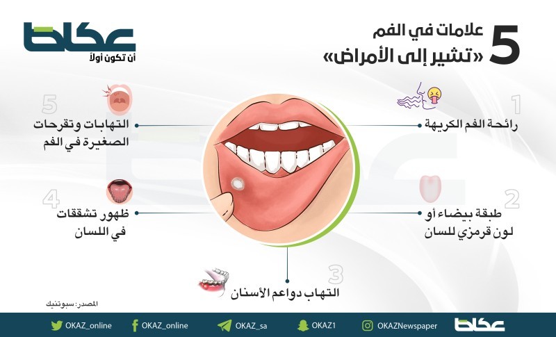 5 علامات في الفم تشير إلى الأمراض