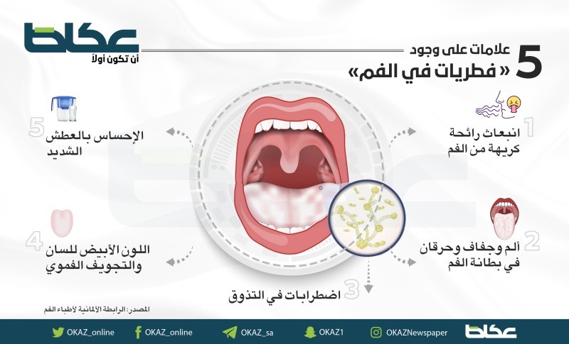 5 علامات على وجود فطريات في الفم – أخبار السعودية