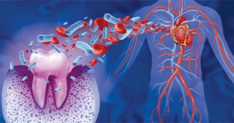 هل هناك علاقة بين قوة القلب وصحة الفم؟ دراسة تجيب وترسل تحذيرات