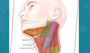 علماء يرسمون استراتيجيات دقيقة لسرطان الرأس والرقبة