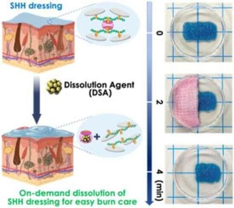 تطوير «هيدروجيل» يعزز التئام حروق الدرجة الثانية