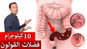 هل لدينا حقًا ما يعادل 10 كيلوجرام من الفضلات السامة في القولون؟ | تنظيف وتطهير القولون