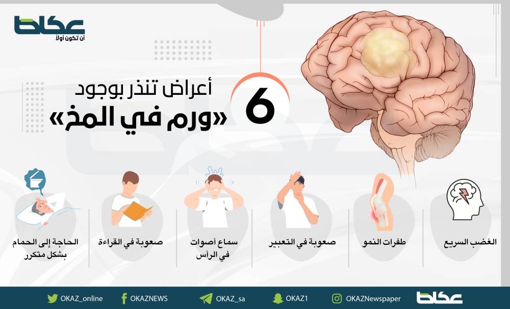 6 أعراض تنذر بوجود ورم في المخ – أخبار السعودية