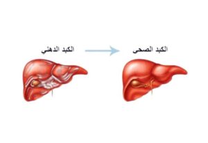 أمريكا توافق على أول دواء لعلاج «الكبد الدهني» – أخبار السعودية